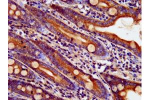IHC image of ABIN7145227 diluted at 1:400 and staining in paraffin-embedded human small intestine tissue performed on a Leica BondTM system.