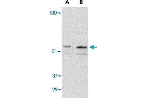 Western blot analysis of PAK2 in Jurkat lysate with PAK2 polyclonal antibody  at (A) 0. (PAK2 antibody  (C-Term))
