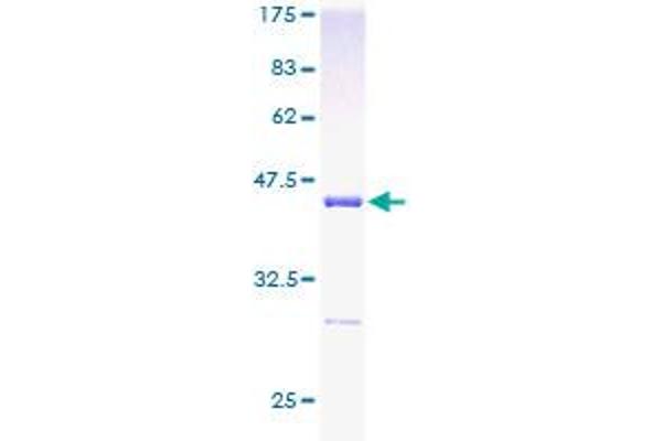 UBE2L3 Protein (AA 1-154) (GST tag)