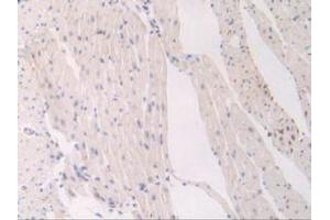 IHC-P analysis of Mouse Heart Tissue, with DAB staining. (FLT1 antibody  (AA 27-329))
