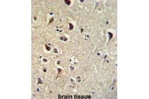 Immunohistochemistry (IHC) image for anti-Kruppel-Like Factor 11 (KLF11) antibody (ABIN3002716) (KLF11 antibody)