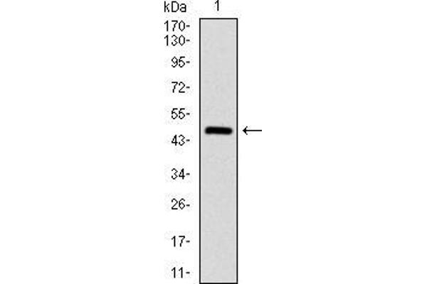 ASS1 anticorps