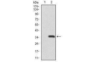 Image no. 2 for anti-Recombination Activating Gene 1 (RAG1) antibody (ABIN1491682) (RAG1 antibody)