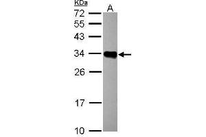 WB Image Sample (30 ug of whole cell lysate) A: Raji 12% SDS PAGE antibody diluted at 1:1000 (HLA-DRB1 antibody)