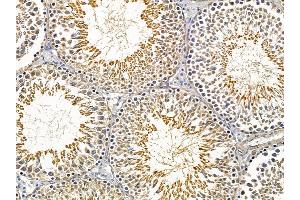 ABIN6257415 and ABIN6275226 at 1/100 staining rat testis tissue by IHC-P.