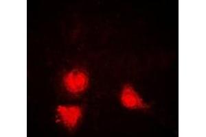Immunofluorescent analysis of SIRT1 staining in Jurkat cells. (SIRT1 antibody)