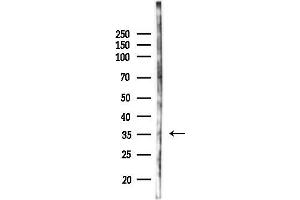 anti-Ring Finger Protein 115 (RNF115) antibody