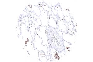 Alveolar macrophages show strong TIM 3 immunostaining (Recombinant TIM3 antibody)