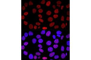 Confocal immunofluorescence analysis of HeLa cells using Histone H2AX Polyclonal Antibody (ABIN6134695, ABIN6141564, ABIN6141567 and ABIN6219268) at dilution of 1:200. (Histone H2A antibody)