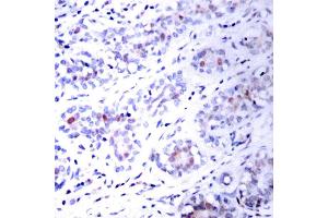 Image no. 2 for anti-Signal Transducer and Activator of Transcription 3 (Acute-Phase Response Factor) (STAT3) antibody (ABIN271827) (STAT3 antibody)