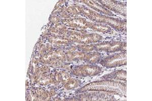 Immunohistochemical staining of human stomach with WDR5B polyclonal antibody , upper shows moderate cytoplasmic positivity in glandular cells at 1:10-1:20 dilution. (WDR5B antibody)