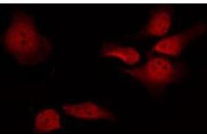 ABIN6277169 staining RAW264. (Presenilin 1 antibody  (Internal Region))
