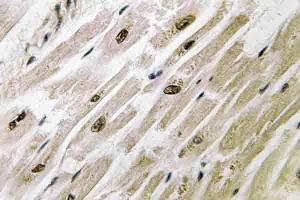 Immunohistochemistry (IHC) analyzes of PAKγ antibody in paraffin-embedded human heart tissue. (PAK2 antibody)