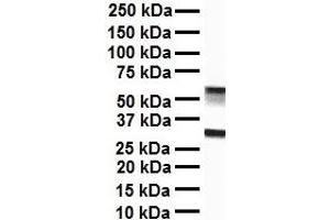 WB Suggested Anti-ZFX antibody Titration: 1 ug/mL Sample Type: Human liver (ZFX antibody  (C-Term))