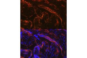Immunofluorescence analysis of human placenta using Aromatase (CYP19) Rabbit mAb (2238) at dilution of 1:100 (40x lens). (Aromatase antibody)