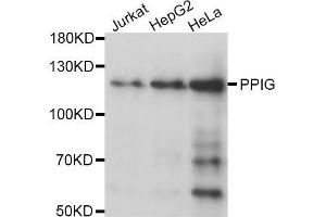 Western blot analysis of extracts of various cell lines, using PPIG antibody (ABIN5970160) at 1/1000 dilution.