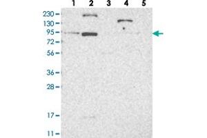 Western blot analysis of Lane 1: RT-4, Lane 2: U-251 MG, Lane 3: Human Plasma, Lane 4: Liver, Lane 5: Tonsil with LCA5 polyclonal antibody . (LCA5 antibody)