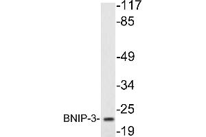 Western blot (WB) analysis of BNIP-3 antibody in extracts from K562cells. (BNIP3 antibody)