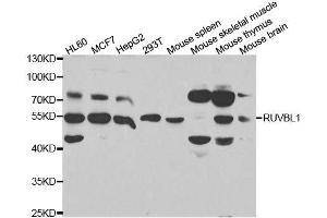 Western blot analysis of extracts of various cell lines, using RUVBL1 antibody. (RUVBL1 antibody  (AA 1-240))