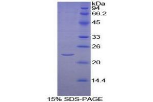 SDS-PAGE analysis of Human KLRC2 Protein. (KLRC2 Protein)