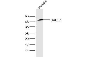 Mouse muscle lysates probed with Rabbit Anti-BACE1 Polyclonal Antibody, Unconjugated  at 1:5000 for 90 min at 37˚C. (BACE1 antibody  (AA 401-501))