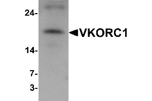Western blot analysis of VKORC1 in A549 cell lysate with VKORC1 antibody at 1 µg/mL.