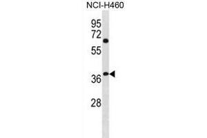 NHLRC3 Antibody (C-term) (ABIN1881580 and ABIN2838947) western blot analysis in NCI- cell line lysates (35 μg/lane). (NHLRC3 antibody  (C-Term))
