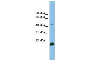 WB Suggested Anti-TGFB2 Antibody Titration: 0. (TGFB2 antibody  (Middle Region))