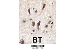 IHC analysis of FFPE human brain tissue stained with TIE1 antibody (TIE1 antibody  (AA 12-42))