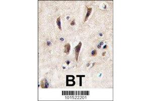 IHC analysis of FFPE human brain tissue stained with TIE1 antibody (TIE1 antibody  (AA 12-42))
