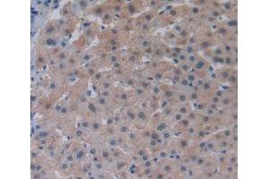 Figure. (LPCAT3 antibody  (AA 122-233))