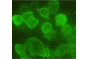 293 cells transfected with N-terminal HA tag protein.