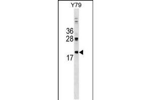 Western blot analysis in Y79 cell line lysates (35ug/lane). (DNAJC5 antibody  (AA 52-80))