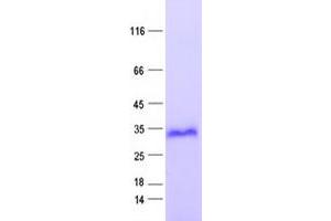 Validation with Western Blot (FHL2 Protein (His tag))