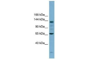 IARS antibody used at 1 ug/ml to detect target protein. (IARS antibody  (N-Term))
