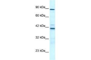 WB Suggested Anti-TBX5 Antibody Titration:  0. (T-Box 5 antibody  (Middle Region))