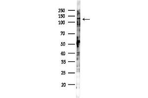 Western blot analysis of lysates from K562 cells(UV,30 min treatment), using Phospho-FAK (Tyr397) Antibody at 1/1000 dilution.