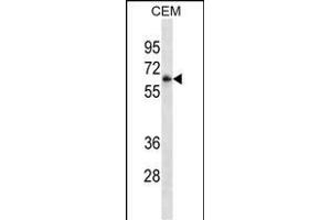 FCGR3A Antibody ABIN1539896 western blot analysis in CEM cell line lysates (35 μg/lane). (FCGR3A antibody  (AA 60-88))
