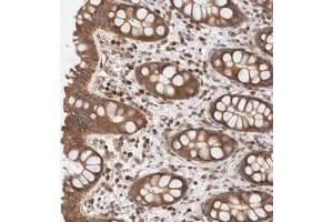 Immunohistochemical staining of human rectum with RP5-1000E10.