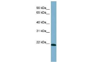 WB Suggested Anti-TIRAP Antibody Titration: 0. (TIRAP antibody  (Middle Region))