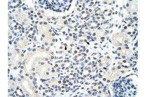 SSB antibody was used for immunohistochemistry at a concentration of 4-8 ug/ml to stain Epithelial cells of renal tubule (arrows) in Human Kidney.