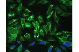 Immunofluorescence analysis of U-2 OS cells using OGN Polyclonal Antibody at dilution of 1:100. (OGN antibody)