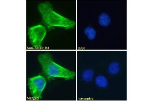 ABIN570800 Immunofluorescence analysis of paraformaldehyde fixed A431 cells, permeabilized with 0. (SLCO1B3 antibody  (Internal Region))