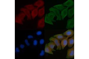 ABIN6258556 and ABIN6275402 staining Hela cells by IF/ICC. (POTEB antibody  (C-Term))