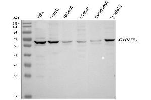 Western blot analysis of CYP27B1 using anti-CYP27B1 antibody (ABIN3042787).