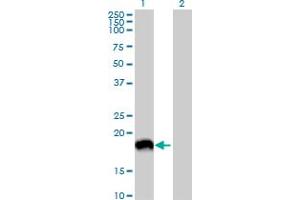 Western Blot analysis of MAP1LC3A expression in transfected 293T cell line by MAP1LC3A MaxPab polyclonal antibody. (MAP1LC3A antibody  (AA 1-121))