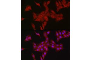 Immunofluorescence analysis of PC-12 cells using RBCK1 antibody (ABIN7269848) at dilution of 1:100. (RBCK1 antibody)
