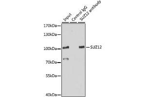 Immunoprecipitation (IP) image for anti-SUZ12 Polycomb Repressive Complex 2 Subunit (SUZ12) (AA 470-739) antibody (ABIN6148752)
