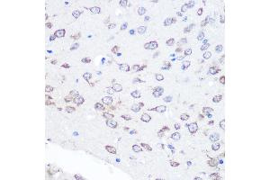 Immunohistochemistry (IHC) image for anti-Fibroblast Growth Factor 2 (Basic) (FGF2) antibody (ABIN7267184)