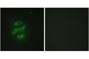 Immunofluorescence (IF) image for anti-Cytochrome P450, Family 2, Subfamily J, Polypeptide 2 (CYP2J2) (AA 231-280) antibody (ABIN2889947) (CYP2J2 antibody  (AA 231-280))
